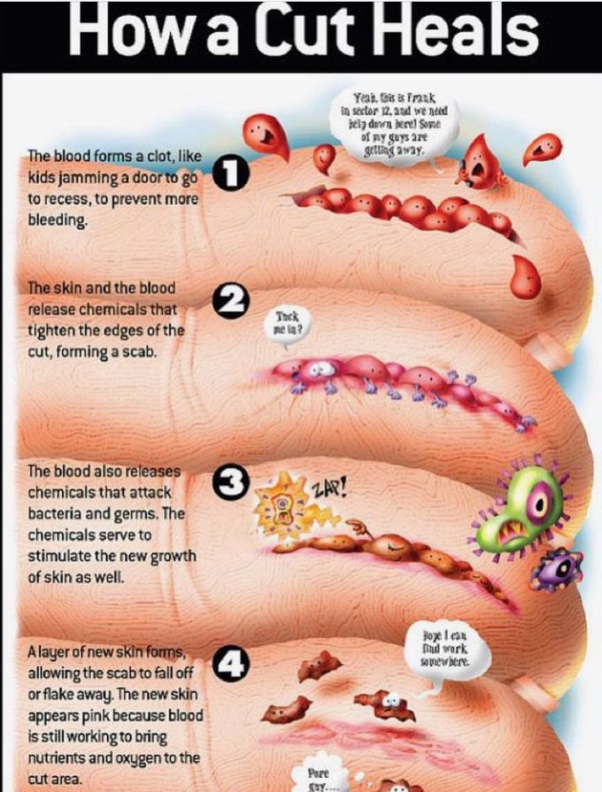 How a cut heals?