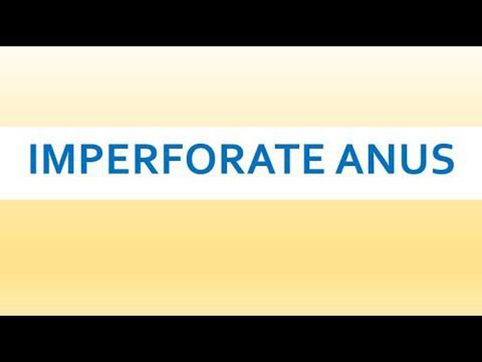Imperforate Anus: Introduction