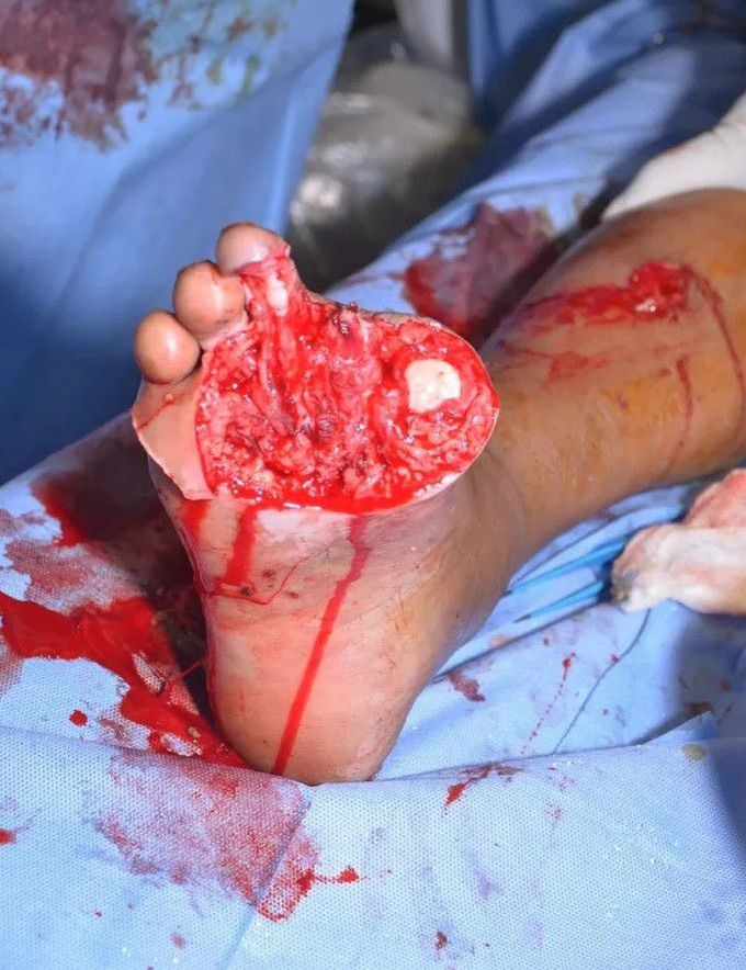 orthopedic surgery