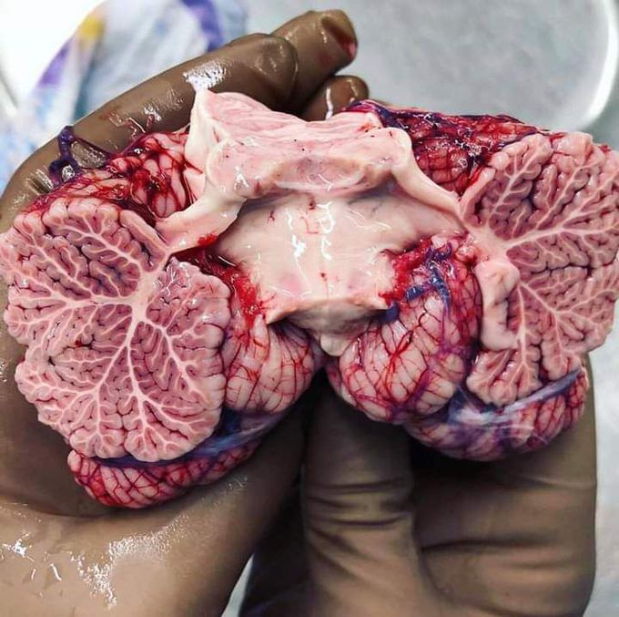 Beautiful photo of the human cerebellum!😍