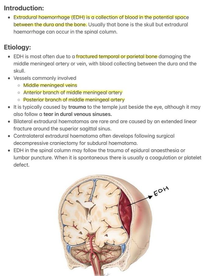 Extradural Hematoma I