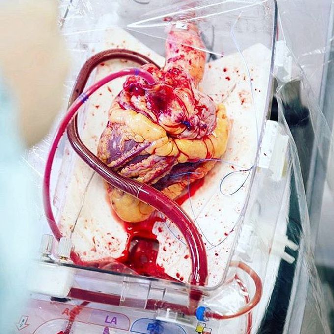 A beating heart in a box!!!