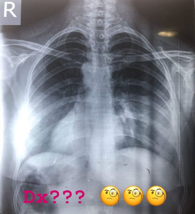 What's the your diagnosis??