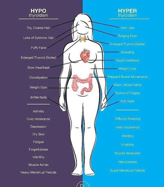 Hypo vs hyper thyroidism