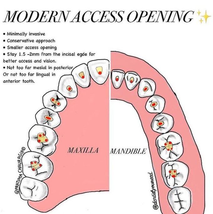 Modern access opening