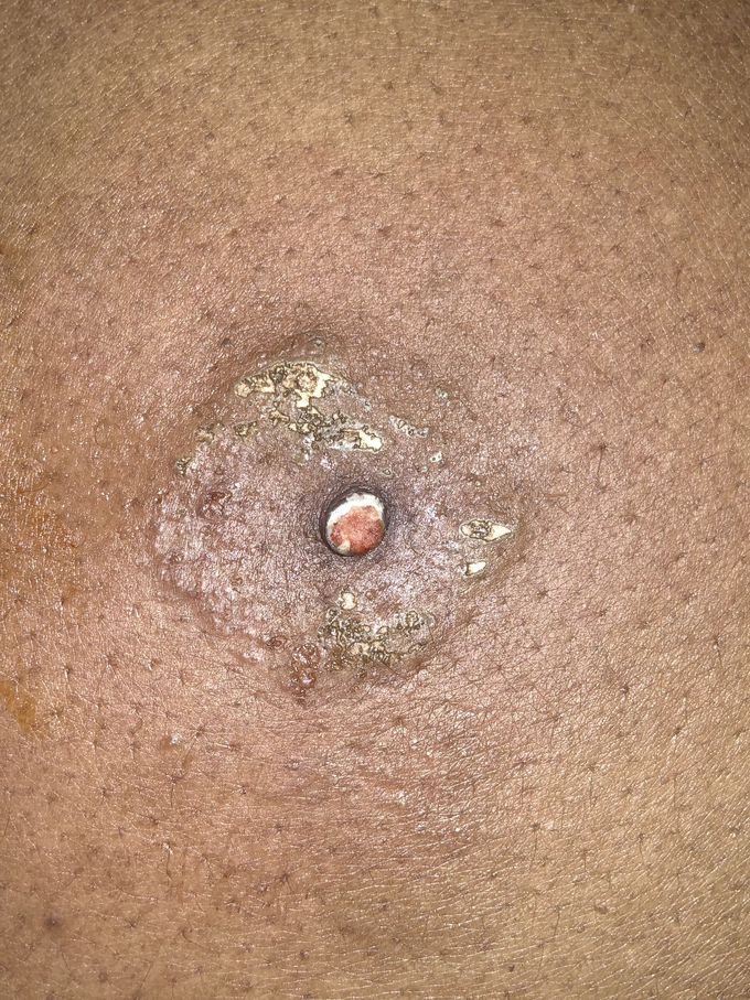 Can Anyone tell what is happening here ?