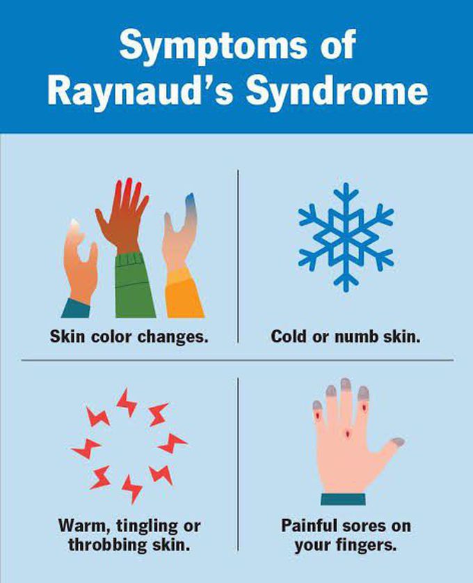 These are the symptoms of Raynauds syndrome