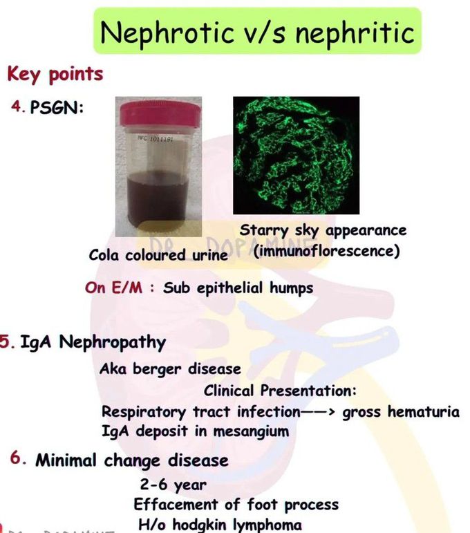 Nephrotic Vs Nephrotic Syndrome II