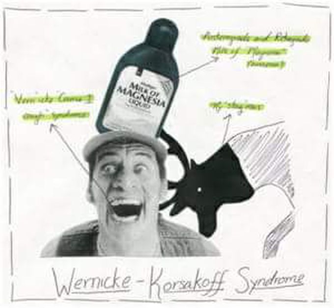 What Is Wernicke-Korsakof Syndrome?
_______________________________________
Wernicke-Korsakof syndrome is a brain disorder due to thiamine (vitamin B1) deficiency.

Also called wet brain, Korsakoff’s psychosis, and alcoholic encephalopathy, it is the combined presence of Wernicke’s encephalopathy (WE) and Korsakoff’s syndrome.

Causes Of Wernicke-Korsakof Syndrome:

Wernicke-Korsakof syndrome is caused by:

Vitamin B1 deficiency
High consumption of alcohol
malabsorption (inability of the body to effectively absorb food)
Symptoms Of Wernicke-Korsakof Syndrome:

Some common symptoms may include:

Confusion and loss of mental activity that can progress to coma and death
Loss of muscle coordination (ataxia)
Leg tremor
Vision changes
abnormal eye movements (nystagmus),
double vision
eyelid drooping
Alcohol withdrawal
Inability to form new memories
Loss of memory
Making up stories (confabulation)
Seeing or hearing things that are not really there (hallucinations)
Diagnosis Of Wernicke-Korsakof Syndrome:

Wernicke-Korsakof syndrome can be diagnosed by:

Clinical impression
formal neuropsychological assessment
Examination of the nervous/muscular system
Tests to check nutrition level
Serum albumin (relates to person’s general nutrition)
Serum vitamin B1 levels
Transketolase activity in red blood cells (reduced in people with thiamine deficiency)
Treatment Of Wernicke-Korsakof Syndrome:

The goals of treatment are to control symptoms and to prevent the disorder from getting worse.

Treatment includes:

Vitamin B1 injections
Monitoring and special care may be needed if the person is:
Comatose
Lethargic
Unconscious
Stopping alcohol use
Eating a well-balanced, nourishing diet