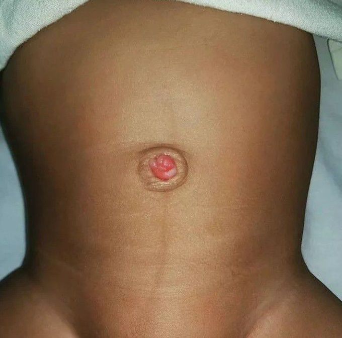 general surgery