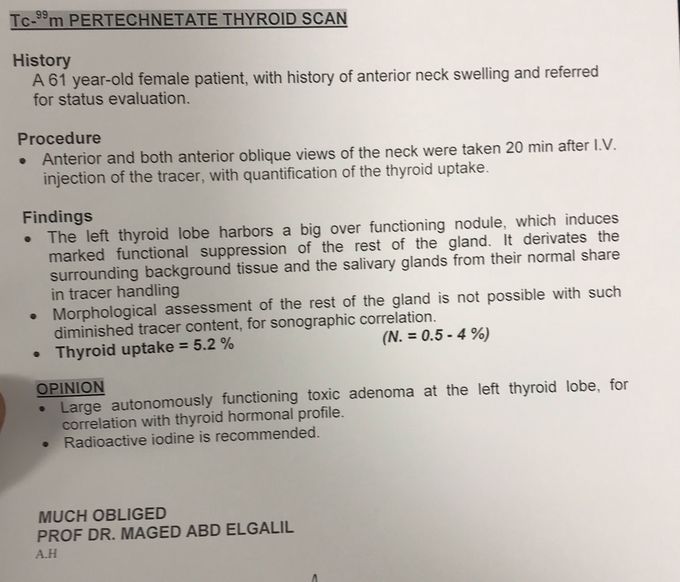 Thyroid nodule