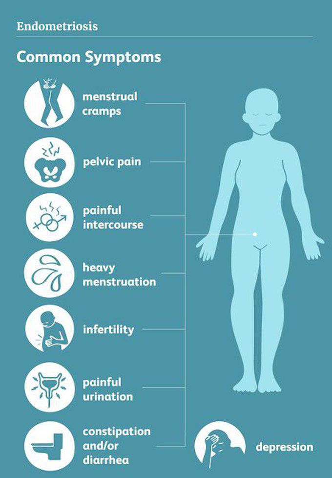 Signs of endometriosis