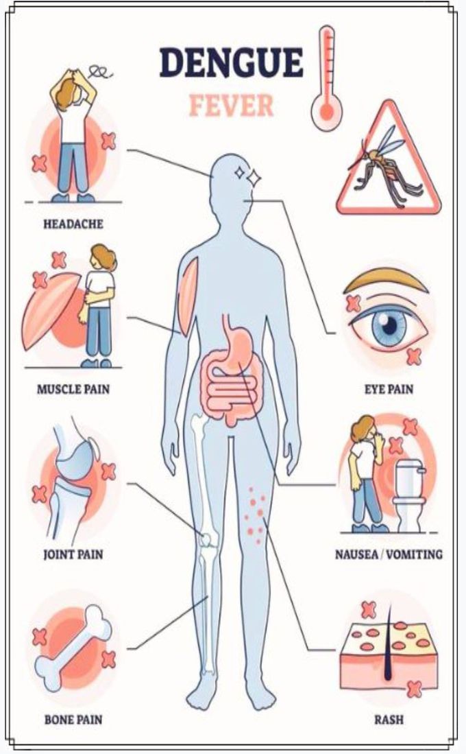 Symptoms of dengue
