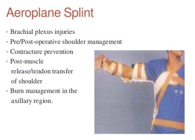 Aeroplane Splint