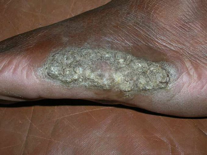What is your diagnosis ?