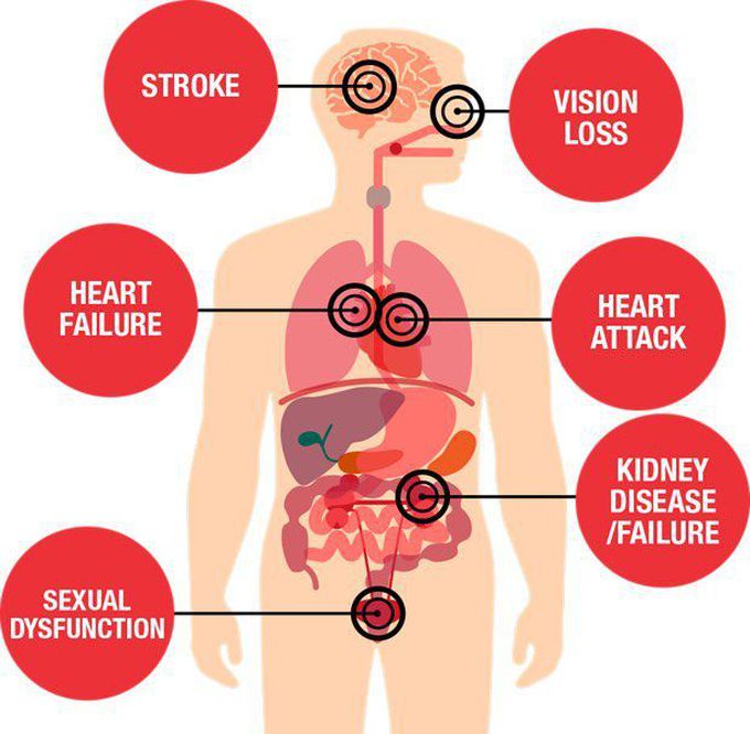 Hypertension effects