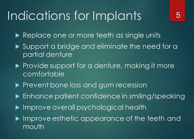 Indications of Dental Implants