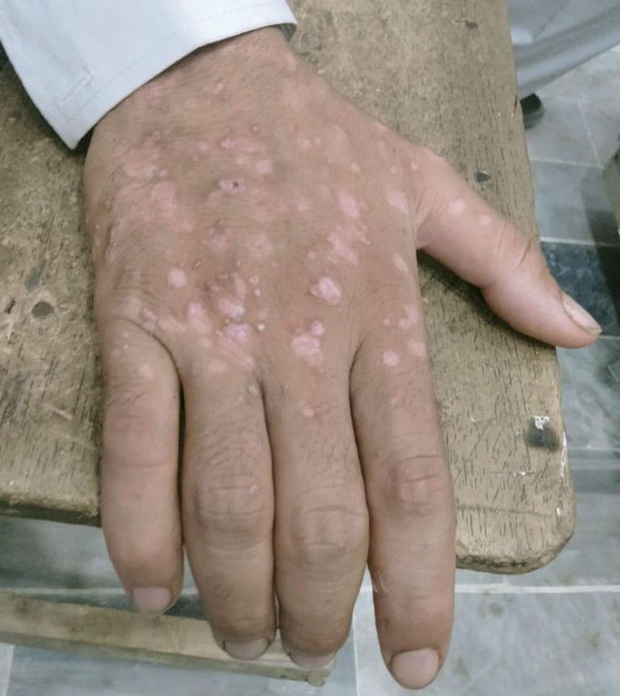 Kindly Diagnose