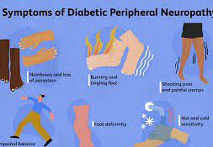 These are the symptoms of sugar peripheral neuropathy