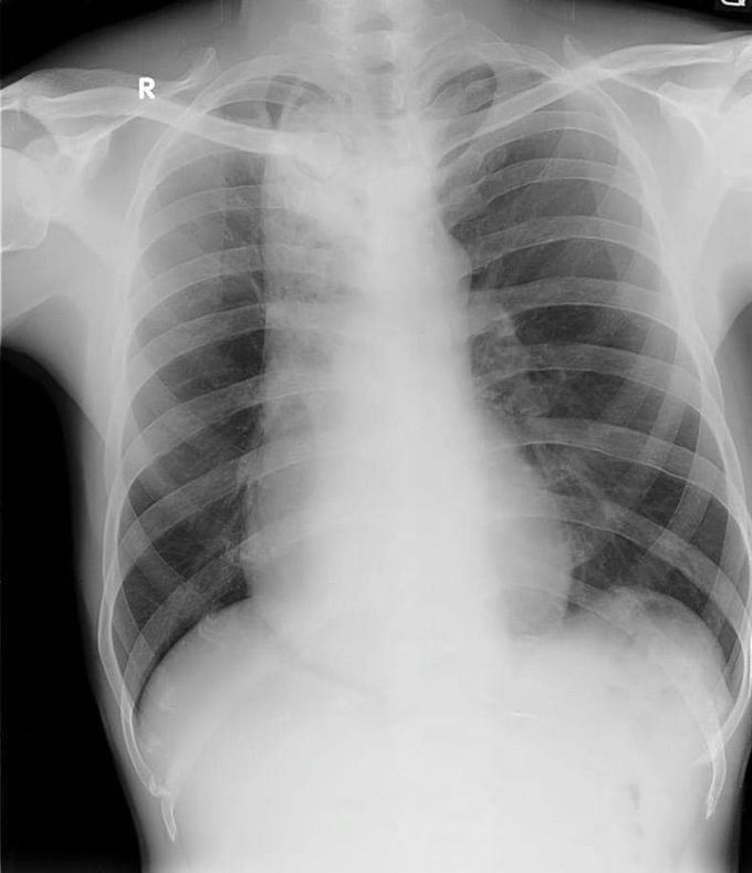 What is your diagnosis 🧐