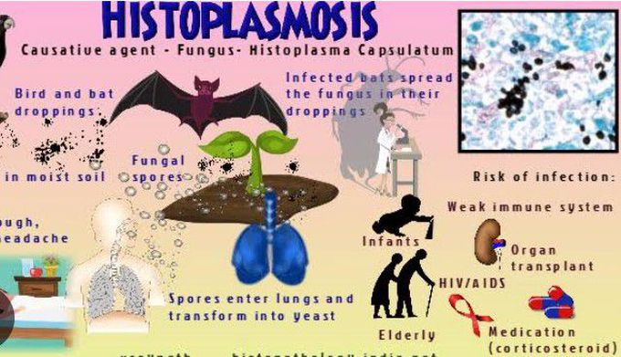 Cause of Histoplasmosis