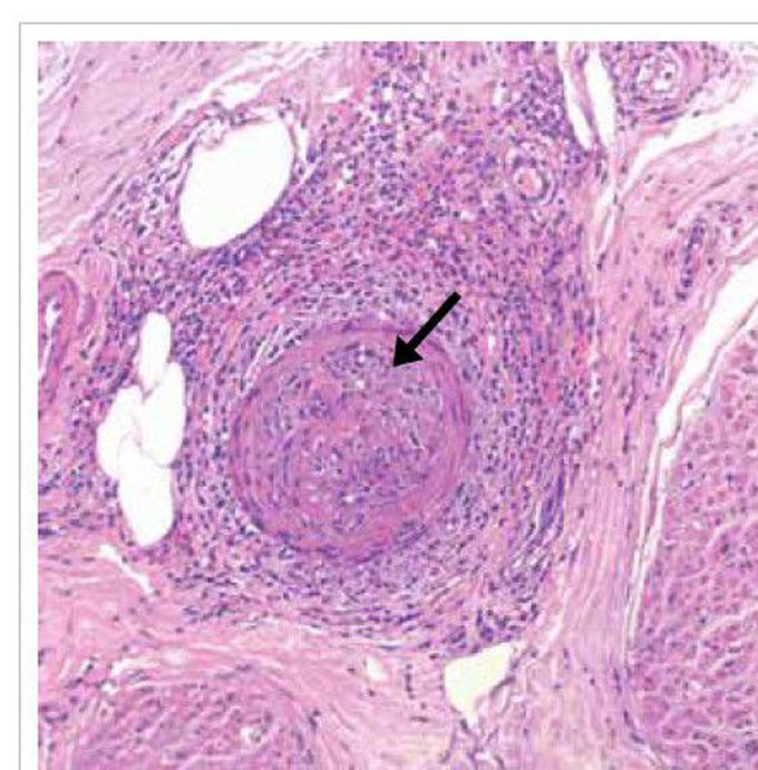 What is your diagnosis