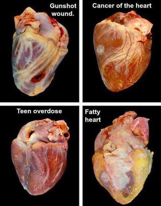 Heart