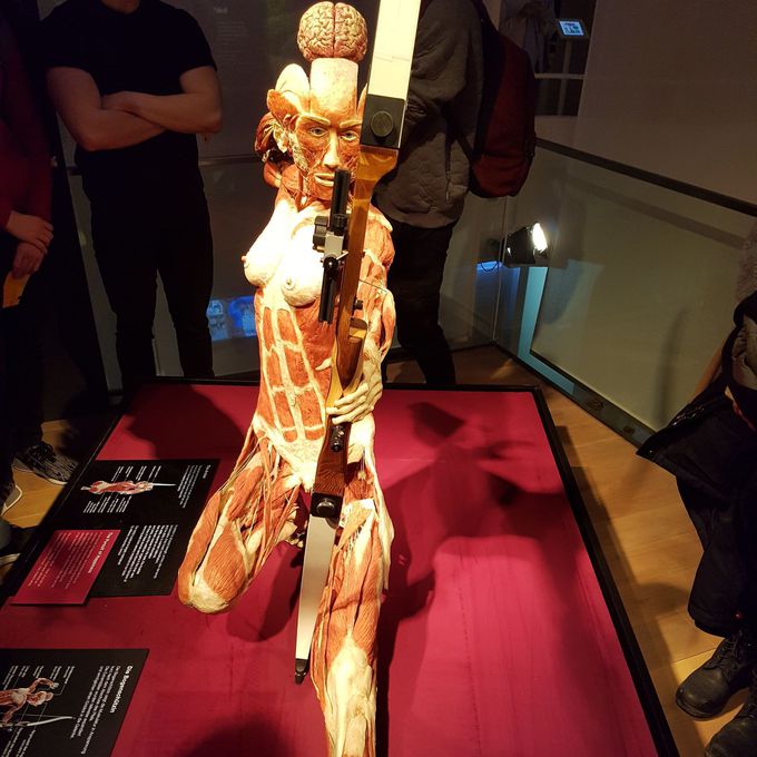 Plastination# Art vs. Med.