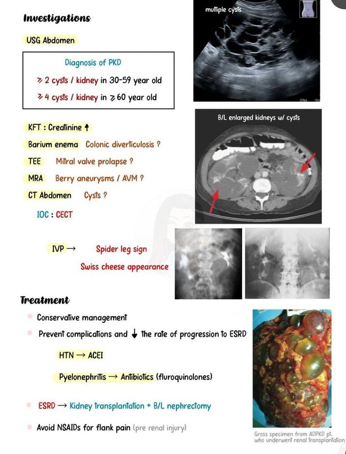 Polycystic Kidney Disease II