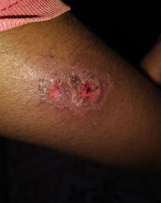 What is diagnosis??