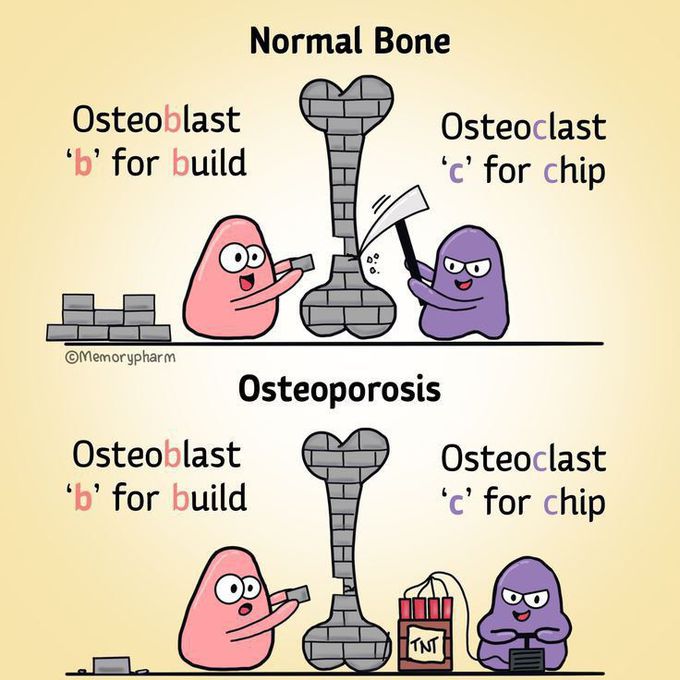Normal bone 🦴 &Osteoporosis