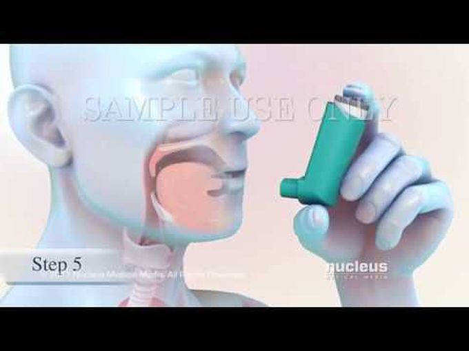 Utilising a metered-dose inhaler