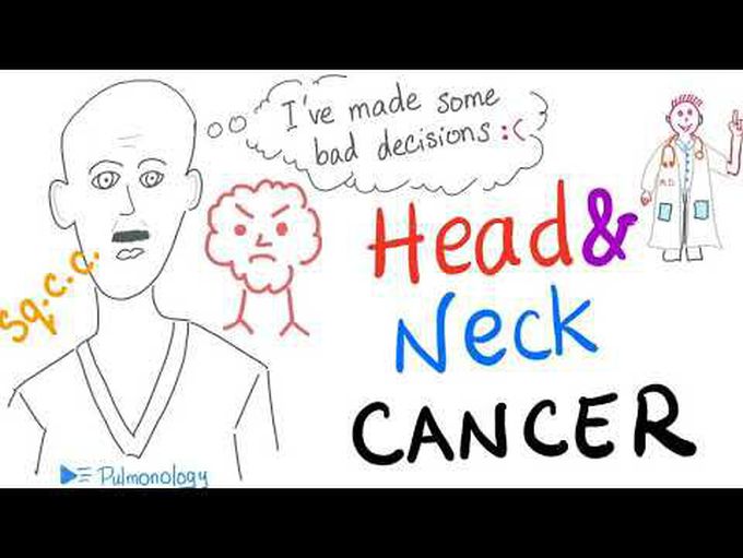 Head and Neck Cancer (Risk Factors, Pathology, Clinical Picture, Diagnosis and Management)