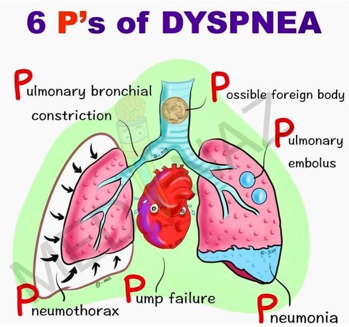 Dyspnea