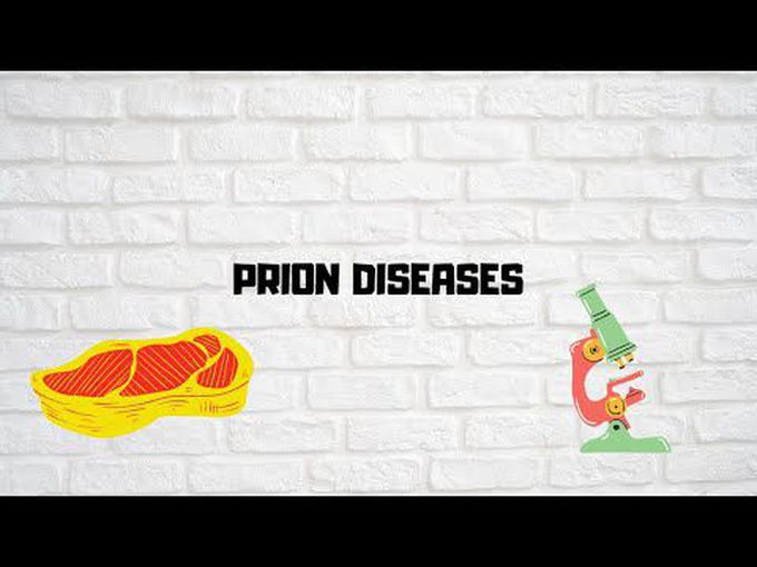 Prion Diseases