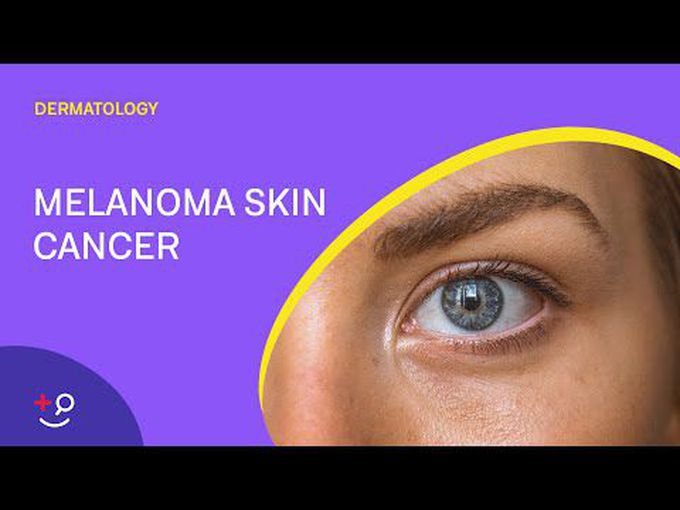 Melanoma as a skin cancer