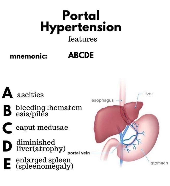 Portal Hypertension MEDizzy