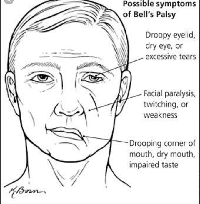 Face deformities