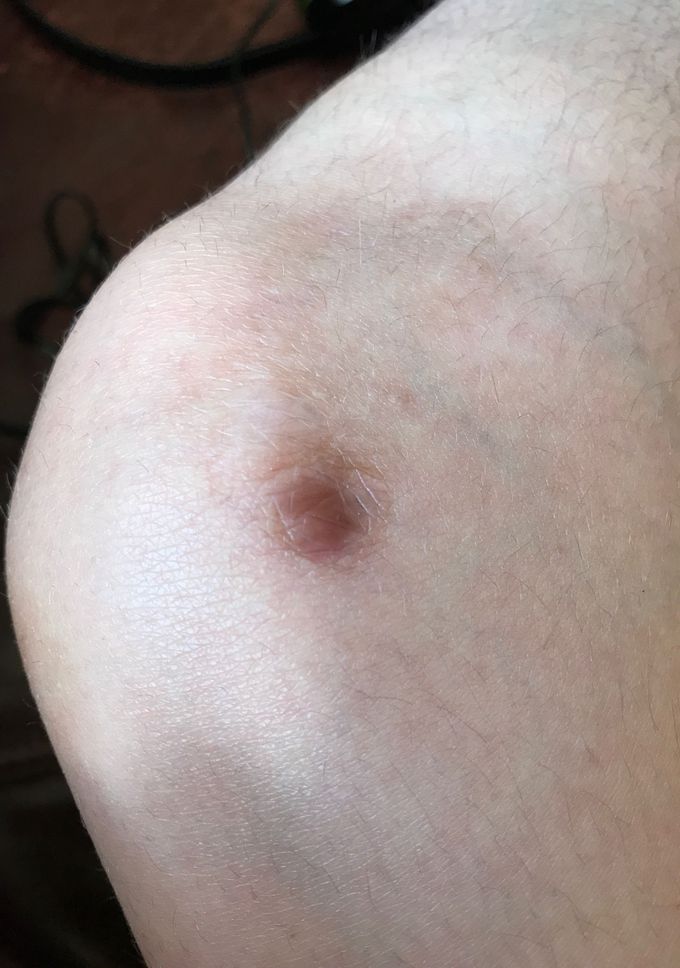 Help me identify this scar