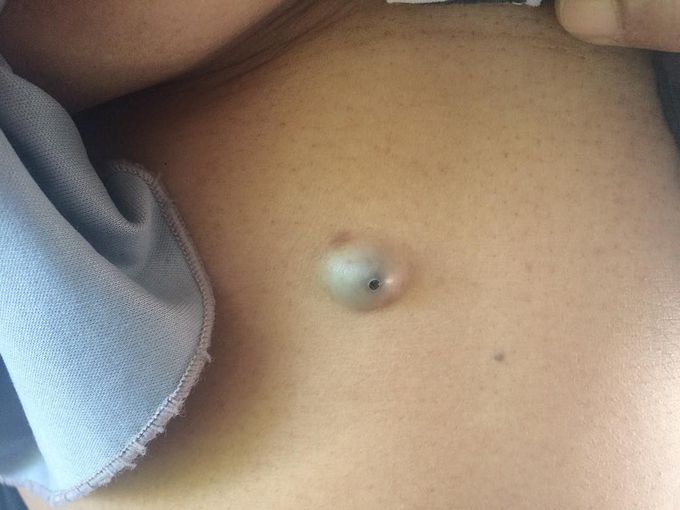 Diagnosis??