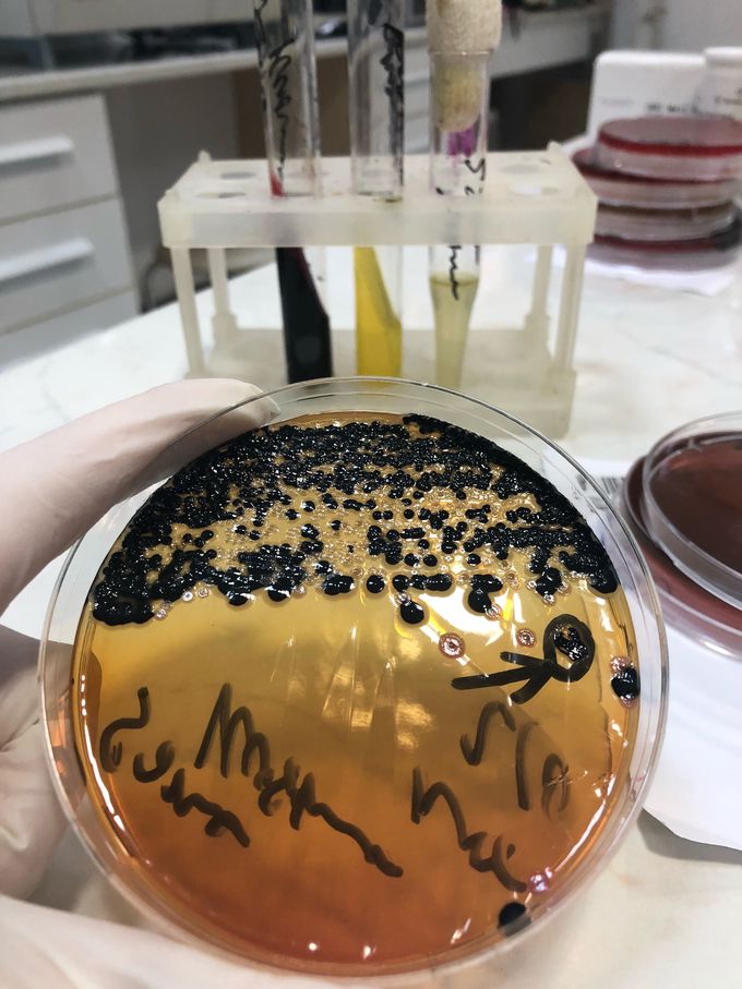 This is cultivation of fecalis. You can see black colonies on Salmonella Shigella agar. They are Salmonella group. TSI has black deep and gas, Urease and Indol tests were negative.