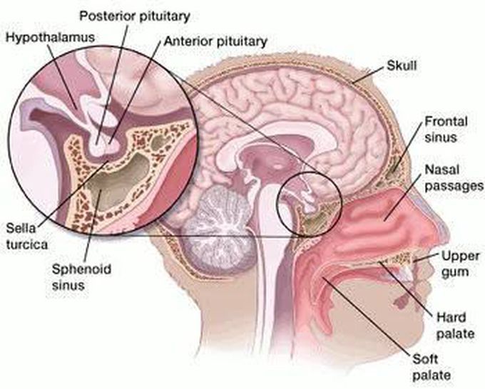 Causes of pituitary adenoma