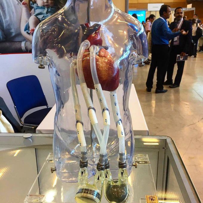 An artificial pediatric ventricle