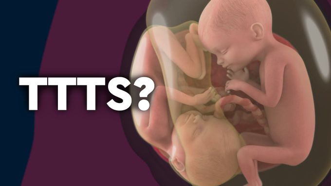 Twin-to-Twin Transfusion Syndrome