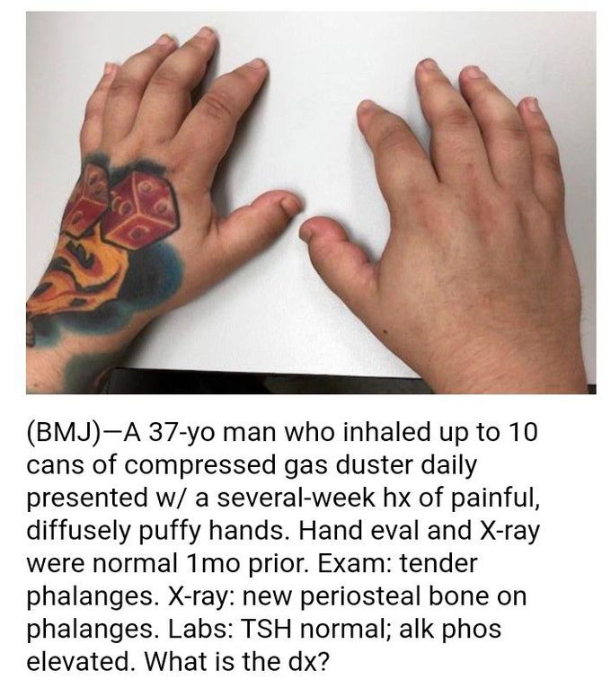 Dx??