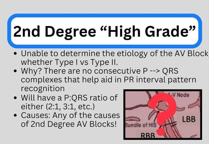 2nd Degree High Grade