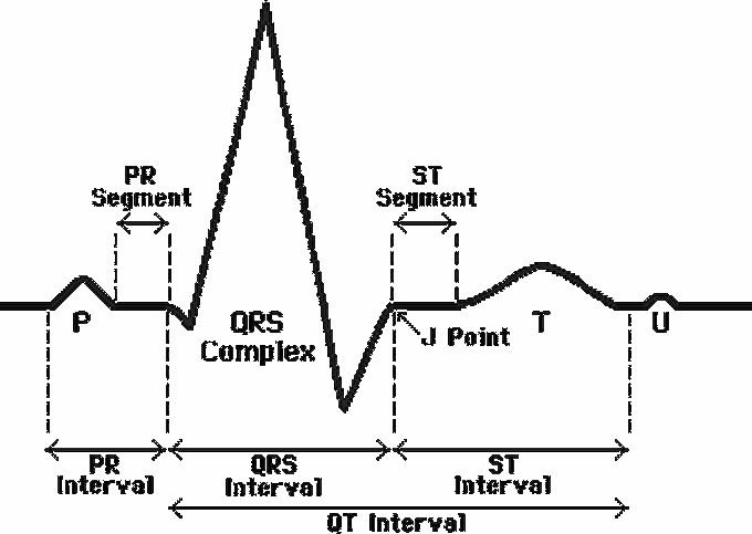 Basics of Electrocardiogram - MEDizzy