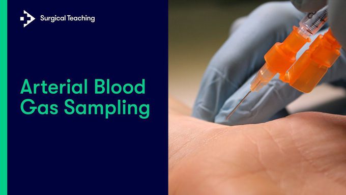 Arterial Blood Gas Sampling: Tutorial