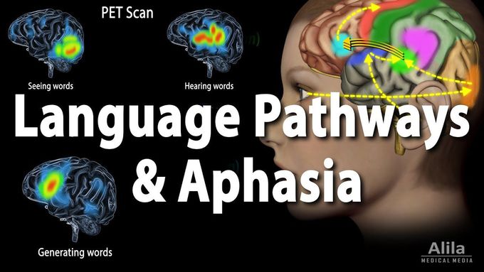 Language Pathways and Aphasia