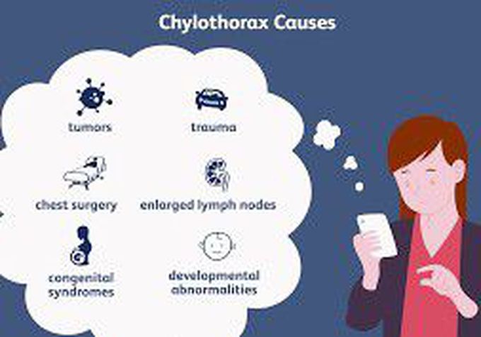 Chylothorax causes